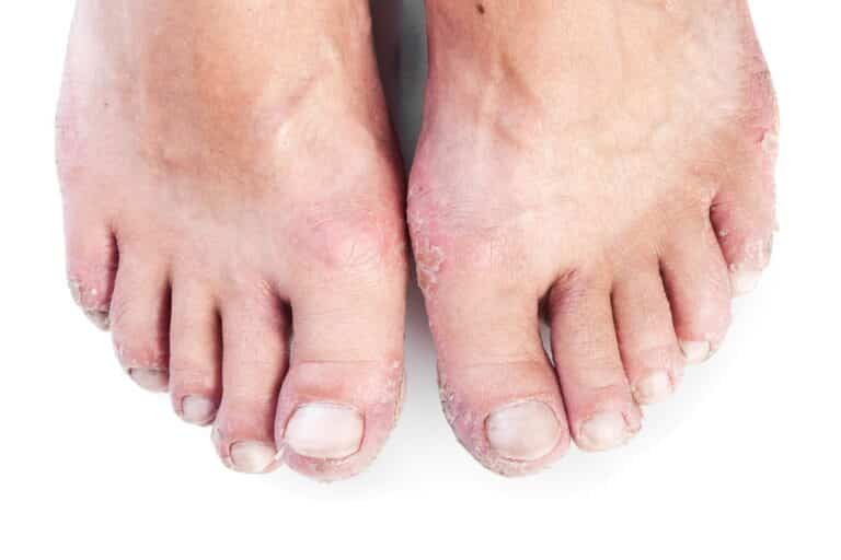 Vinegar Foot Soaks Benefits and Tips Own Harmony