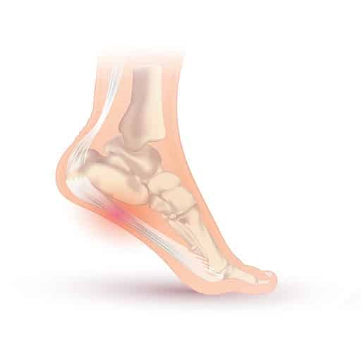 Numb Heel Symptoms, Prevention, Treatment Own Harmony